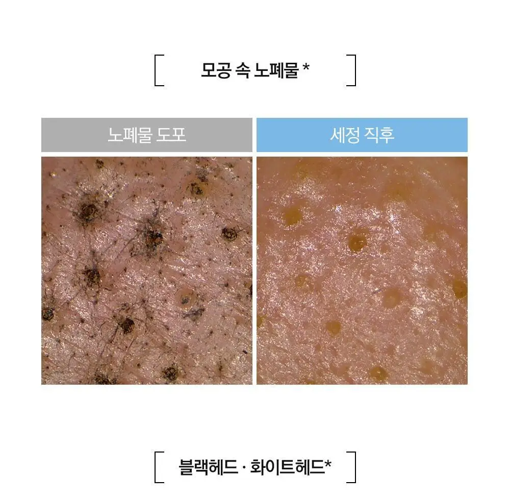 [보습민감/모공세정] 라곰 저자극 마이크로 포어  클렌징 오일 200ml 상세페이지 21